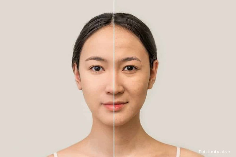 Buoi va phong ngua lao hoa