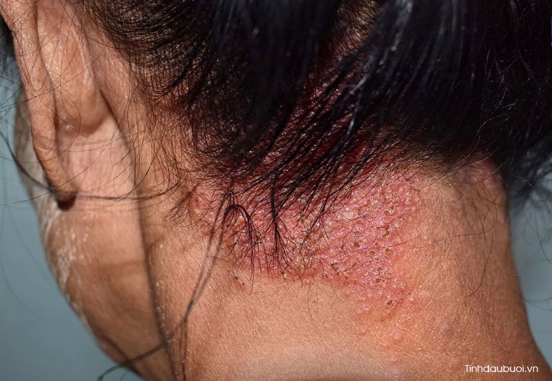 cach duong toc bang tinh dau buoi