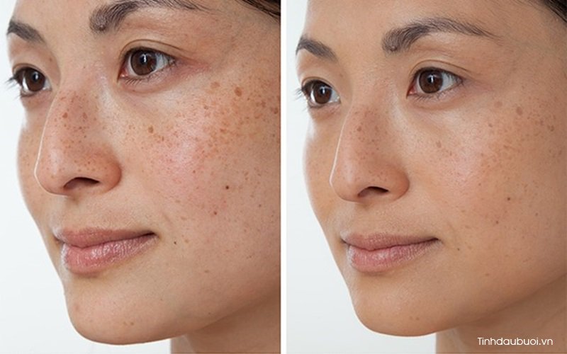 cao vo buoi co tac dung gi