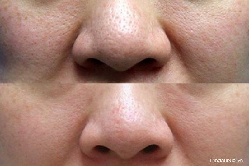 Tắm vỏ bưởi mang lại những lợi ích gì tam vo buoi mang lai nhung loi ich gi