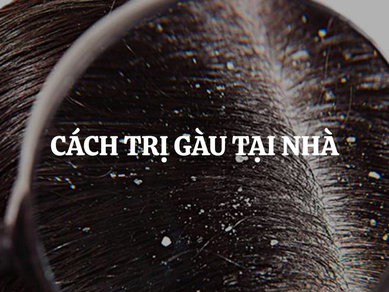 13 Cách trị gàu tại nhà hiệu quả bằng nguyên liệu tự nhiên cực hiệu quả, dễ thực hiện
