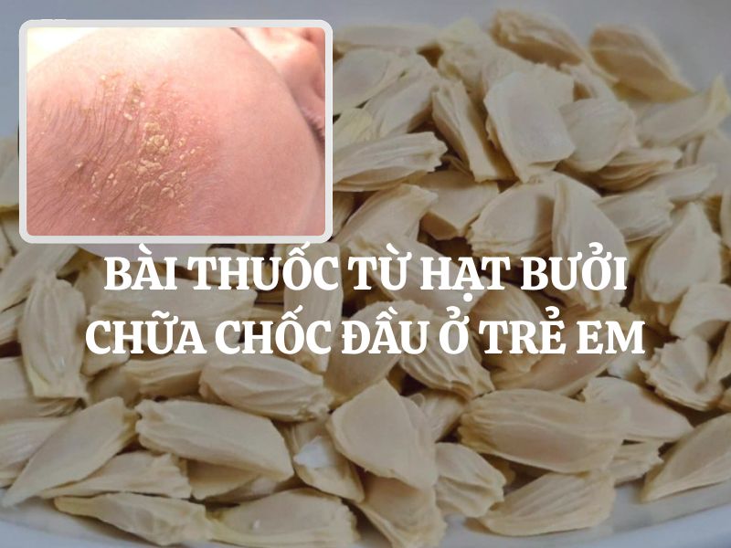 Bất ngờ với bài thuốc từ hạt bưởi chữa chốc đầu ở trẻ em cực hay