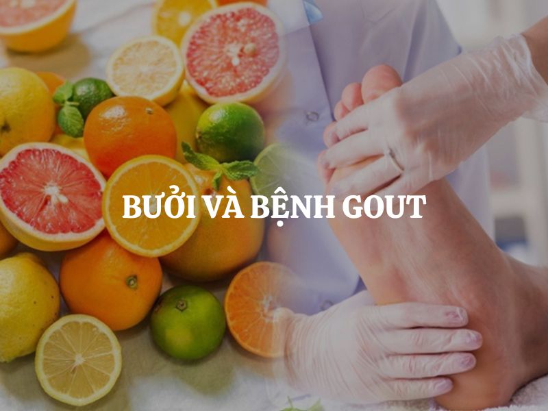Bưởi và bệnh Gout: Người có chỉ số axit uric cao có nên ăn không? Lợi ích và lưu ý quan trọng