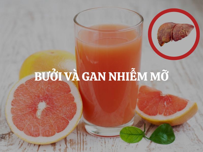 Bưởi và gan nhiễm mỡ: Có thật sự giúp cải thiện tình trạng mỡ gan không?