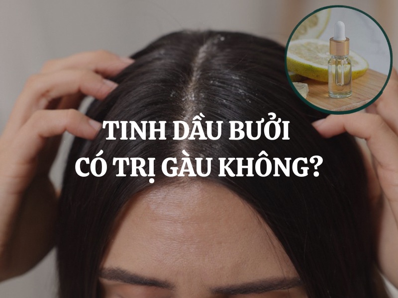 Tinh dầu bưởi có trị gàu không? Giải đáp chi tiết và cách dùng hiệu quả