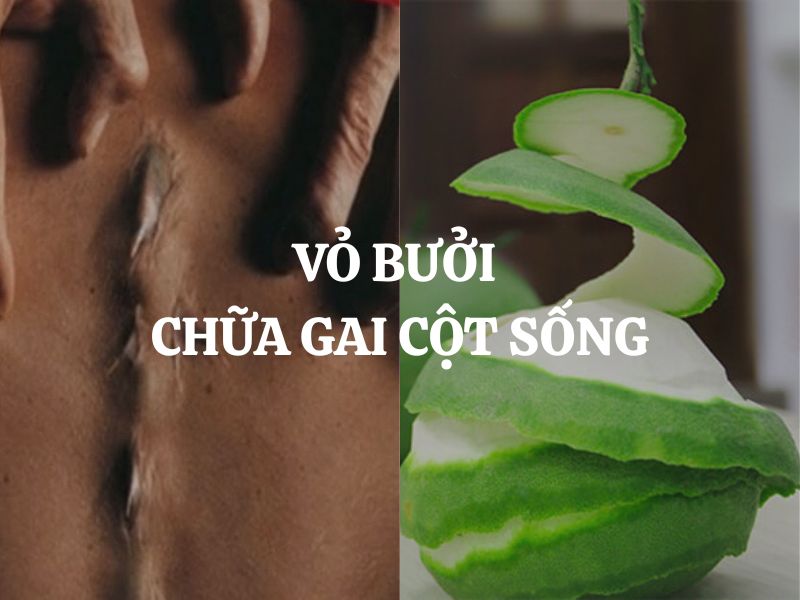 Vỏ bưởi chữa gai cột sống có hiệu quả không? Cách dùng đúng và lưu ý quan trọng