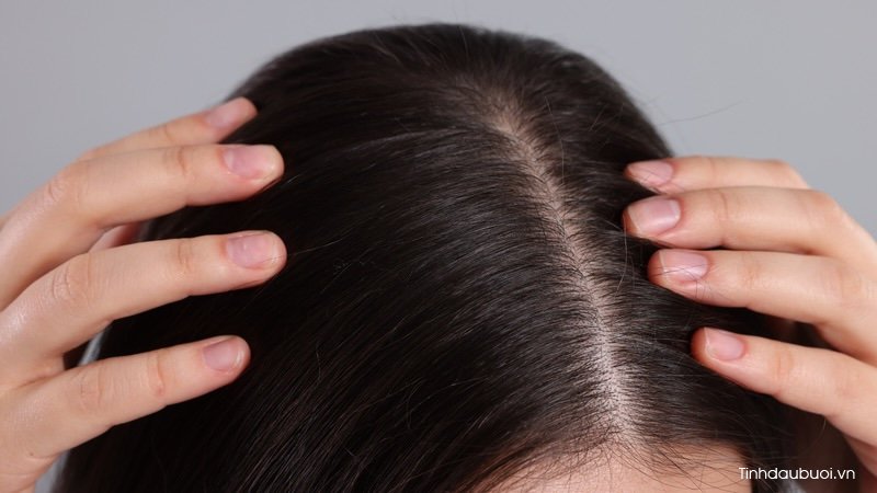 Cách dùng vỏ bưởi trị gàu Cach dung vo buoi tri gau