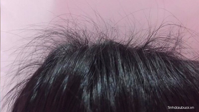 tinh dầu bưởi có giúp mọc tóc tinh dau buoi co giup moc toc