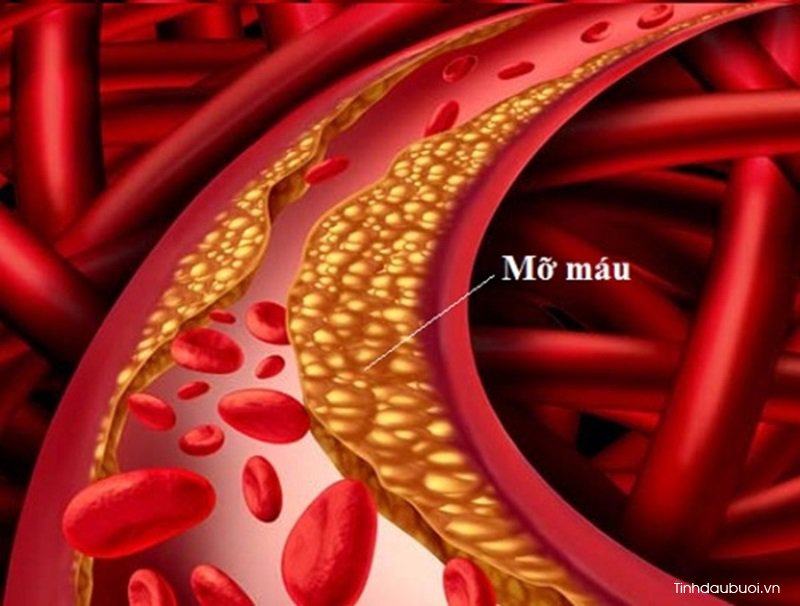 vo buoi giup giam mo mau