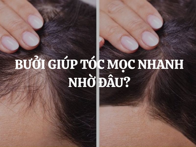 Bưởi giúp tóc mọc nhanh nhờ đâu? Bí quyết chăm sóc tóc chắc khỏe từ thiên nhiên