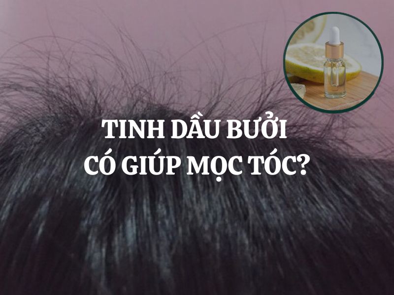 Dùng tinh dầu bưởi có giúp mọc tóc không? Cách dùng hiệu quả nhất Dùng tinh dầu bưởi có giúp mọc tóc không? Cách dùng hiệu quả nhất