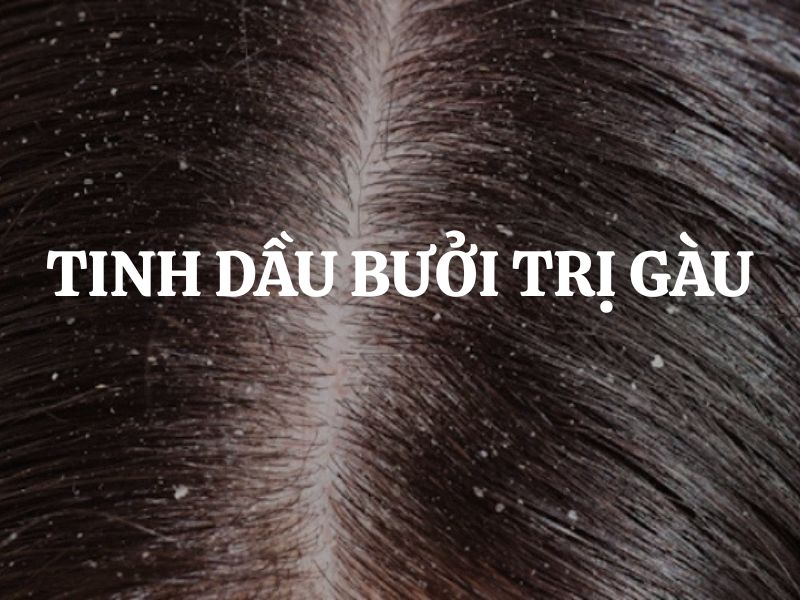 Tinh dầu bưởi trị gàu và bí quyết chăm sóc da đầu khỏe mạnh
