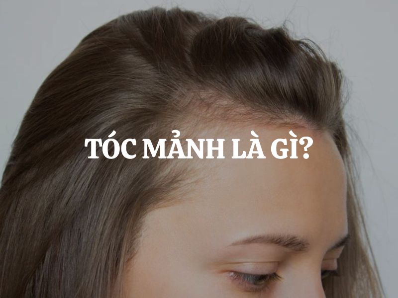 Tóc mảnh là gì? Cách khắc phục nhược điểm tóc mỏng yếu